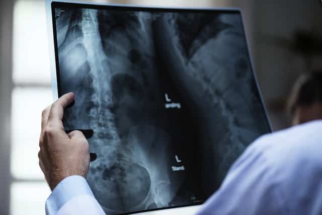 A doctor looks at an x-ray of bones